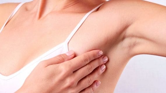 10 Faktor Penyebab Seseorang Bisa Terjangkit Kanker Payudara